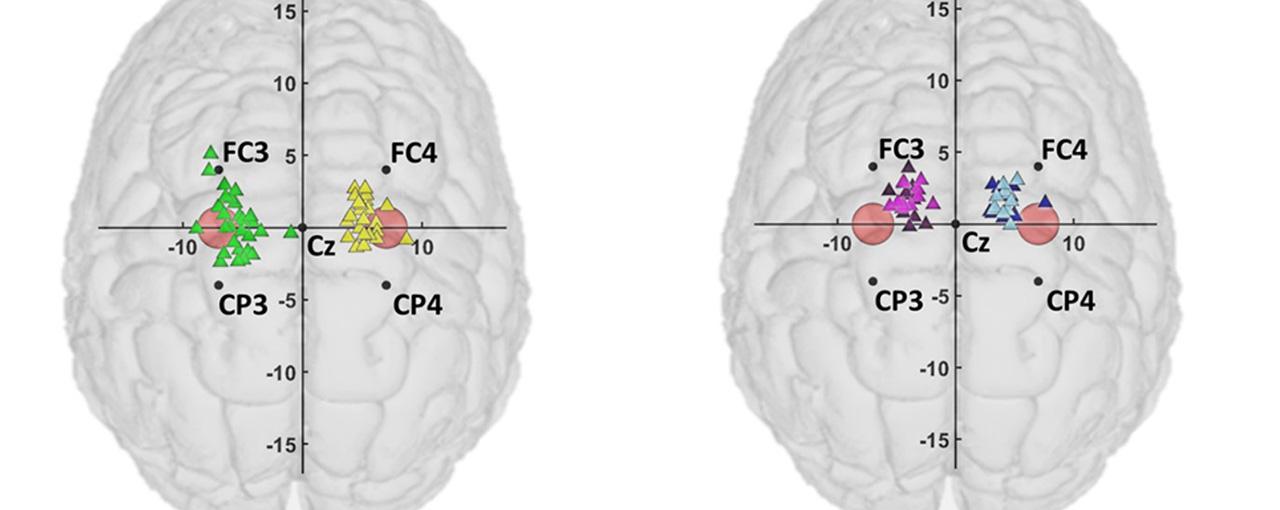 정상인과 뇌졸중 환자의 최적의 뇌전기자극 위치인 motor hotspot 위치,